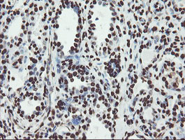 NONO / P54NRB Antibody - IHC of paraffin-embedded Human breast tissue using anti-NONO mouse monoclonal antibody.