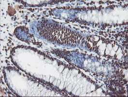 NONO / P54NRB Antibody - IHC of paraffin-embedded Human colon tissue using anti-NONO mouse monoclonal antibody.