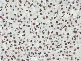 NONO / P54NRB Antibody - IHC of paraffin-embedded Human liver tissue using anti-NONO mouse monoclonal antibody.