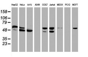 NONO / P54NRB Antibody - Western blot of extracts (35ug) from 9 different cell lines by using anti-NONO monoclonal antibody (HepG2: human; HeLa: human; SVT2: mouse; A549: human; COS7: monkey; Jurkat: human; MDCK: canine; PC12: rat; MCF7: human).