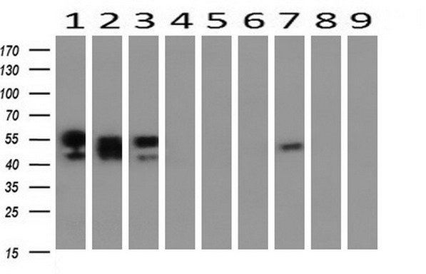 NONO / P54NRB Antibody - Western blot of extracts (10ug) from 9 Human tissue by using anti-NONO monoclonal antibody at 1:200 (1: Testis; 2: Omentum; 3: Uterus; 4: Breast; 5: Brain; 6: Liver; 7: Ovary; 8: Thyroid gland; 9: Colon).