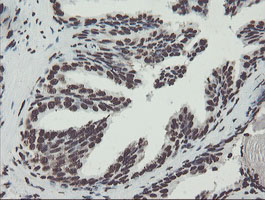 NONO / P54NRB Antibody - IHC of paraffin-embedded Human prostate tissue using anti-NONO mouse monoclonal antibody. (Heat-induced epitope retrieval by 10mM citric buffer, pH6.0, 100C for 10min).