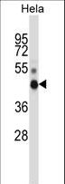 NONO / P54NRB Antibody - NONO Antibody western blot of HeLa cell line lysates (35 ug/lane). The NONO antibody detected the NONO protein (arrow).