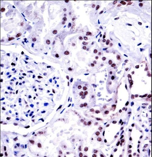 NONO / P54NRB Antibody - NONO Antibody immunohistochemistry of formalin-fixed and paraffin-embedded human kidney tissue followed by peroxidase-conjugated secondary antibody and DAB staining.