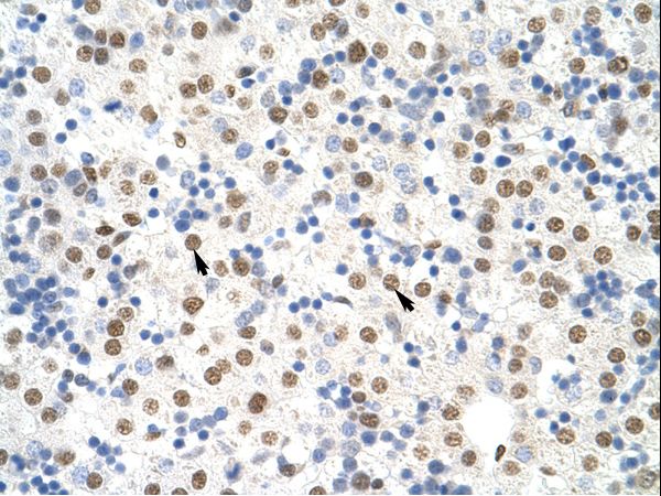NONO / P54NRB Antibody - NONO antibody ARP40716_T100-NP_031389-NONO (non-POU domain containing, octamer-binding) Antibody was used in IHC to stain formalin-fixed, paraffin-embedded human liver.  This image was taken for the unconjugated form of this product. Other forms have not been tested.