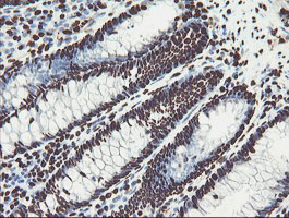 NONO / P54NRB Antibody - IHC of paraffin-embedded Human colon tissue using anti-NONO mouse monoclonal antibody.