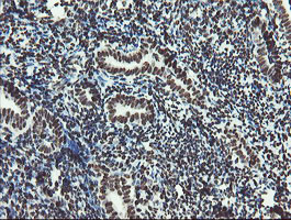 NONO / P54NRB Antibody - IHC of paraffin-embedded Human endometrium tissue using anti-NONO mouse monoclonal antibody.