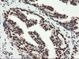 NONO / P54NRB Antibody - IHC of paraffin-embedded Human prostate tissue using anti-NONO mouse monoclonal antibody.
