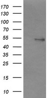 NONO / P54NRB Antibody - HEK293T cells were transfected with the pCMV6-ENTRY control (Left lane) or pCMV6-ENTRY NONO (Right lane) cDNA for 48 hrs and lysed. Equivalent amounts of cell lysates (5 ug per lane) were separated by SDS-PAGE and immunoblotted with anti-NONO.