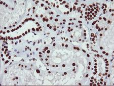NONO / P54NRB Antibody - IHC of paraffin-embedded Human Kidney tissue using anti-NONO mouse monoclonal antibody.