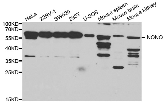 NONO / P54NRB Antibody - Western blot analysis of extracts of various cell lines.