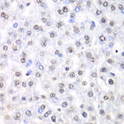 NONO / P54NRB Antibody - Immunohistochemistry of paraffin-embedded rat liver tissue.