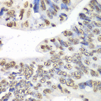 NONO / P54NRB Antibody - Immunohistochemistry of paraffin-embedded human colon tissue.