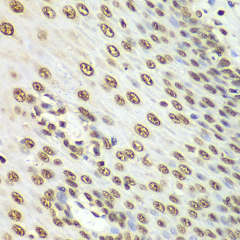 NONO / P54NRB Antibody - Immunohistochemistry of paraffin-embedded human esophageal tissue.