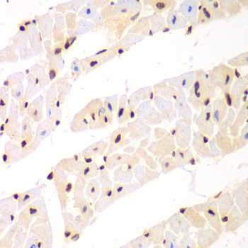 NONO / P54NRB Antibody - Immunohistochemistry of paraffin-embedded mouse heart.