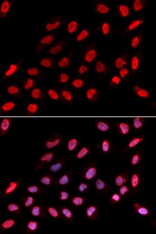 NONO / P54NRB Antibody - Immunofluorescence analysis of U20S cells.