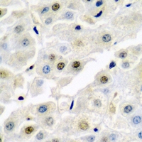 NONO / P54NRB Antibody - Immunohistochemical analysis of p54nrb staining in rat liver formalin fixed paraffin embedded tissue section. The section was pre-treated using heat mediated antigen retrieval with sodium citrate buffer (pH 6.0). The section was then incubated with the antibody at room temperature and detected using an HRP conjugated compact polymer system. DAB was used as the chromogen. The section was then counterstained with hematoxylin and mounted with DPX.