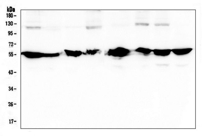 NONO / P54NRB Antibody - Western blot analysis of nmt55 p54nrb using anti-nmt55 p54nrb antibody. Electrophoresis was performed on a 5-20% SDS-PAGE gel at 70V (Stacking gel) / 90V (Resolving gel) for 2-3 hours. The sample well of each lane was loaded with 50ug of sample under reducing conditions. Lane 1: human HELA whole cell lysate, Lane 2: human Placent tissue lysate, Lane 3: human MCF-7 whole cell lysate, Lane 4: human A549 whole cell lysate, Lane 5: human SW620 whole cell lysate, Lane 6: human PANC-1 whole cell lysate, Lane 7: human U20S whole cell lysate, Lane 8: human K562 whole cell lysate. After Electrophoresis, proteins were transferred to a Nitrocellulose membrane at 150mA for 50-90 minutes. Blocked the membrane with 5% Non-fat Milk/ TBS for 1.5 hour at RT. The membrane was incubated with mouse anti-nmt55 p54nrb antigen affinity purified monoclonal antibody at 0.5 µg/mL overnight at 4°C, then washed with TBS-0.1% Tween 3 times with 5 minutes each and probed with a goat anti-mouse IgG-HRP secondary antibody at a dilution of 1:10000 for 1.5 hour at RT. The signal is developed using an Enhanced Chemiluminescent detection (ECL) kit with Tanon 5200 system.
