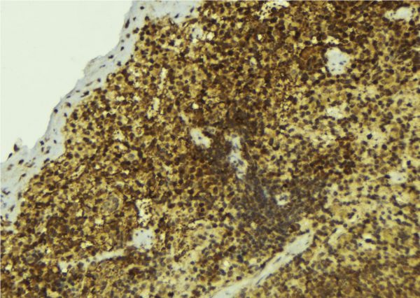 NONO / P54NRB Antibody - 1:100 staining mouse pancreas tissue by IHC-P. The sample was formaldehyde fixed and a heat mediated antigen retrieval step in citrate buffer was performed. The sample was then blocked and incubated with the antibody for 1.5 hours at 22°C. An HRP conjugated goat anti-rabbit antibody was used as the secondary.