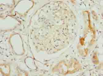 NOP10 Antibody - Immunohistochemistry of paraffin-embedded human kidney tissue using antibody at dilution of 1:100.