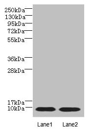 NOP10 Antibody - Western blot All lanes: NOP10 antibody at 4µg/ml Lane 1: Jurkat whole cell lysate Lane 2: Caco-2 whole cell lysate Secondary Goat polyclonal to rabbit IgG at 1/10000 dilution Predicted band size: 8 kDa Observed band size: 8 kDa