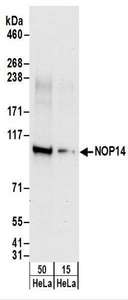 NOP14 / C4orf9 Antibody - Detection of Human NOP14 by Western Blot. Samples: Whole cell lysate (15 and 50 ug) from HeLa cells. Antibodies: Affinity purified rabbit anti-NOP14 antibody used for WB at 0.1 ug/ml. Detection: Chemiluminescence with an exposure time of 30 seconds.