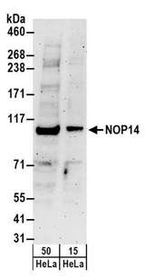 NOP14 / C4orf9 Antibody - Detection of Human NOP14 by Western Blot. Samples: Whole cell lysate (15 and 50 ug) from HeLa cells. Antibodies: Affinity purified rabbit anti-NOP14 antibody used for WB at 0.1 ug/ml. Detection: Chemiluminescence with an exposure time of 3 minutes.