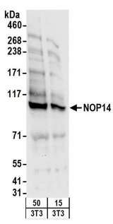 NOP14 / C4orf9 Antibody - Detection of Mouse NOP14 by Western Blot. Samples: Whole cell lysate (15 and 50 ug) from mouse NIH3T3 cells. Antibodies: Affinity purified rabbit anti-NOP14 antibody used for WB at 0.4 ug/ml. Detection: Chemiluminescence with an exposure time of 10 seconds.