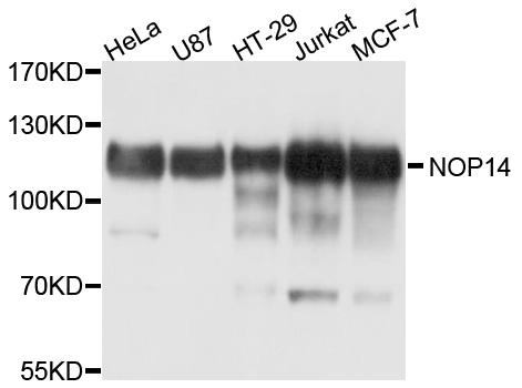 NOP14 / C4orf9 Antibody - Western blot analysis of extracts of various cell lines, using NOP14 antibody at 1:1000 dilution. The secondary antibody used was an HRP Goat Anti-Rabbit IgG (H+L) at 1:10000 dilution. Lysates were loaded 25ug per lane and 3% nonfat dry milk in TBST was used for blocking. An ECL Kit was used for detection and the exposure time was 1s.