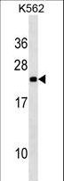 NOP16 Antibody - NOP16 Antibody western blot of K562 cell line lysates (35 ug/lane). The NOP16 antibody detected the NOP16 protein (arrow).