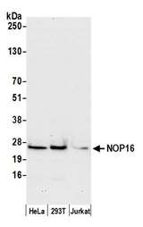 NOP16 Antibody - Detection of human NOP16 by western blot. Samples: Whole cell lysate (50 µg) from HeLa, HEK293T, and Jurkat cells prepared using NETN lysis buffer. Antibody: Affinity purified rabbit anti-NOP16 antibody used for WB at 0.1 µg/ml. Detection: Chemiluminescence with an exposure time of 30 seconds.