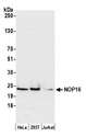 NOP16 Antibody - Detection of human NOP16 by western blot. Samples: Whole cell lysate (50 µg) from HeLa, HEK293T, and Jurkat cells prepared using NETN lysis buffer. Antibody: Affinity purified rabbit anti-NOP16 antibody used for WB at 0.1 µg/ml. Detection: Chemiluminescence with an exposure time of 30 seconds.