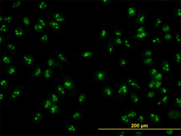 NOP16 Antibody - Immunofluorescence of monoclonal antibody to HSPC111 on HeLa cell. [antibody concentration 10 ug/ml]