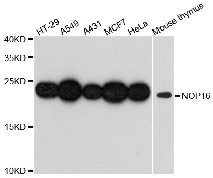 NOP16 Antibody - Western blot analysis of extracts of various cell lines, using NOP16 antibody at 1:3000 dilution. The secondary antibody used was an HRP Goat Anti-Rabbit IgG (H+L) at 1:10000 dilution. Lysates were loaded 25ug per lane and 3% nonfat dry milk in TBST was used for blocking. An ECL Kit was used for detection and the exposure time was 90s.
