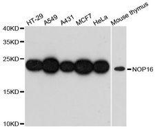 NOP16 Antibody - Western blot analysis of extracts of various cell lines, using NOP16 antibody at 1:3000 dilution. The secondary antibody used was an HRP Goat Anti-Rabbit IgG (H+L) at 1:10000 dilution. Lysates were loaded 25ug per lane and 3% nonfat dry milk in TBST was used for blocking. An ECL Kit was used for detection and the exposure time was 90s.
