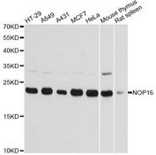 NOP16 Antibody - Western blot analysis of extracts of various cell lines, using NOP16 antibody at 1:3000 dilution. The secondary antibody used was an HRP Goat Anti-Rabbit IgG (H+L) at 1:10000 dilution. Lysates were loaded 25ug per lane and 3% nonfat dry milk in TBST was used for blocking. An ECL Kit was used for detection and the exposure time was 1s.