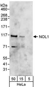NOP2 Antibody - Detection of Human NOL1 by Western Blot. Samples: Whole cell lysate (5, 15 and 50 ug) from HeLa cells. Antibodies: Affinity purified rabbit anti-NOL1 antibody used for WB at 0.1 ug/ml. Detection: Chemiluminescence with an exposure time of 60 seconds.