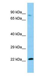 NOP2 Antibody - NOP2 antibody Western Blot of Rat Testis.  This image was taken for the unconjugated form of this product. Other forms have not been tested.