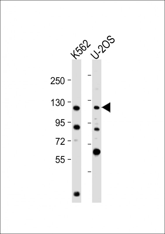 NOP2 Antibody - All lanes: Anti-NOP2 Antibody (N-Term) at 1:2000 dilution Lane 1: K562 whole cell lysate Lane 2: U-2OS whole cell lysate Lysates/proteins at 20 µg per lane. Secondary Goat Anti-Rabbit IgG, (H+L), Peroxidase conjugated at 1/10000 dilution. Predicted band size: 89 kDa Blocking/Dilution buffer: 5% NFDM/TBST.
