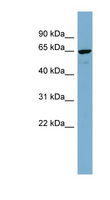 NOP58 / NOP5 Antibody - NOP58 antibody Western blot of MCF7 cell lysate. This image was taken for the unconjugated form of this product. Other forms have not been tested.