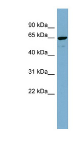 NOP58 / NOP5 Antibody - NOP58 antibody Western blot of MCF7 cell lysate. This image was taken for the unconjugated form of this product. Other forms have not been tested.