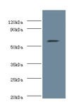 NOP58 / NOP5 Antibody - Western blot of Nucleolar protein 58 antibody at 2 ug/ml with mouse brain tissue Secondary Goat polyclonal to Rabbit IgG at 1:15000 dilution. Predicted band size: 60 KDa. Observed band size: 60 KDa.  This image was taken for the unconjugated form of this product. Other forms have not been tested.