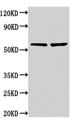 NOP58 / NOP5 Antibody - Western Blot Positive WB detected in: 293 whole cell lysate, 293T whole cell lysate All lanes: NOP58 antibody at 3.75µg/ml Secondary Goat polyclonal to rabbit IgG at 1/50000 dilution Predicted band size: 60 kDa Observed band size: 60 kDa