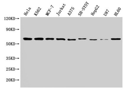 NOP58 / NOP5 Antibody - Western Blot Positive WB detected in: Hela whole cell lysate, K562 whole cell lysate, MCF-7 whole cell lysate, Jurkat whole cell lysate, A375 whole cell lysate, SH-SY5Y whole cell lysate, HepG2 whole cell lysate, U87 whole cell lysate, HL60 whole cell lysate All lanes: NOP58 antibody at 1:2000 Secondary Goat polyclonal to rabbit IgG at 1/50000 dilution Predicted band size: 60 kDa Observed band size: 60 kDa