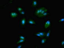 NOP58 / NOP5 Antibody - Immunofluorescent analysis of Hela cells using NOP58 Antibody at dilution of 1:100 and Alexa Fluor 488-congugated AffiniPure Goat Anti-Rabbit IgG(H+L)