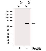 NOP58 / NOP5 Antibody - Western blot analysis of extracts of K562 cells using NOP58 antibody. The lane on the left was treated with blocking peptide.