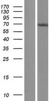 NOP9 Protein - Western validation with an anti-DDK antibody * L: Control HEK293 lysate R: Over-expression lysate