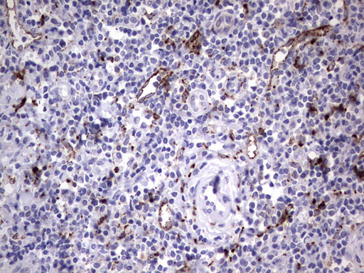 Nor-1 / NR4A3 Antibody - Immunohistochemical staining of paraffin-embedded Human tonsil within the normal limits using anti-NR4A3 mouse monoclonal antibody. (Heat-induced epitope retrieval by 1 mM EDTA in 10mM Tris, pH8.5, 120C for 3min,