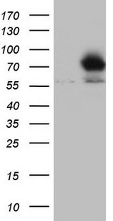 Nor-1 / NR4A3 Antibody - HEK293T cells were transfected with the pCMV6-ENTRY control (Left lane) or pCMV6-ENTRY NR4A3 (Right lane) cDNA for 48 hrs and lysed. Equivalent amounts of cell lysates (5 ug per lane) were separated by SDS-PAGE and immunoblotted with anti-NR4A3.