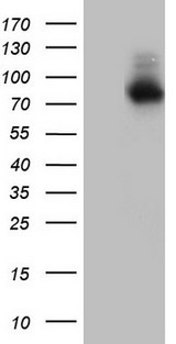 Nor-1 / NR4A3 Antibody - HEK293T cells were transfected with the pCMV6-ENTRY control. (Left lane) or pCMV6-ENTRY NR4A3. (Right lane) cDNA for 48 hrs and lysed. Equivalent amounts of cell lysates. (5 ug per lane) were separated by SDS-PAGE and immunoblotted with anti-NR4A3.